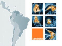 El secreto de los deportistas: Cómo los deportistas potencian su bienestar articular y rendimiento deportivo