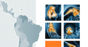 El secreto de los deportistas: Cómo los deportistas potencian su bienestar articular y rendimiento deportivo