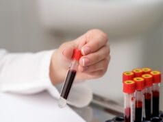 Hemofilia: cuando lo básico no es suficiente