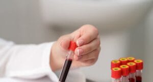 Hemofilia: cuando lo básico no es suficiente