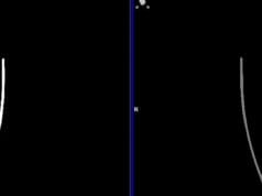 Radiofármacos innovadores permiten diagnósticos más precisos en neuro-oncología y Parkinson.