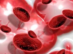 Día Mundial de la Hemofilia 2026: acelerar la ruta de atención es una responsabilidad de todo el sistema