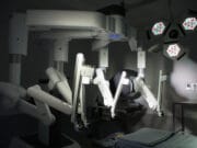 Hito en la Medicina Colombiana: La revolución de la precisión supera las 200 cirugías robóticas en tiempo récord