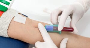 Día Mundial de la Hemofilia: Diagnóstico oportuno y acceso ininterrumpido, la fórmula clave para una vida plena