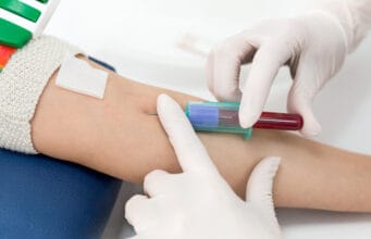 Día Mundial de la Hemofilia: Diagnóstico oportuno y acceso ininterrumpido, la fórmula clave para una vida plena